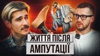 ЙОМУ ВІДРІЗАЛИ НОГУ. ЯК ЖИТИ ПІСЛЯ АМПУТАЦІЇ?│Що ніхто не розповідає про ампутацію та протези